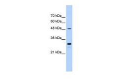 Cytochrome P450 2C9 Rabbit anti-Human, Polyclonal, Novus Biologicals 0.1ml;